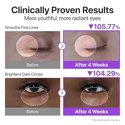 Numbuzin No.9 NAD+ Retinol Volumetox Eye Cream 10ml – Firming &amp; Anti-Aging Eye Treatment